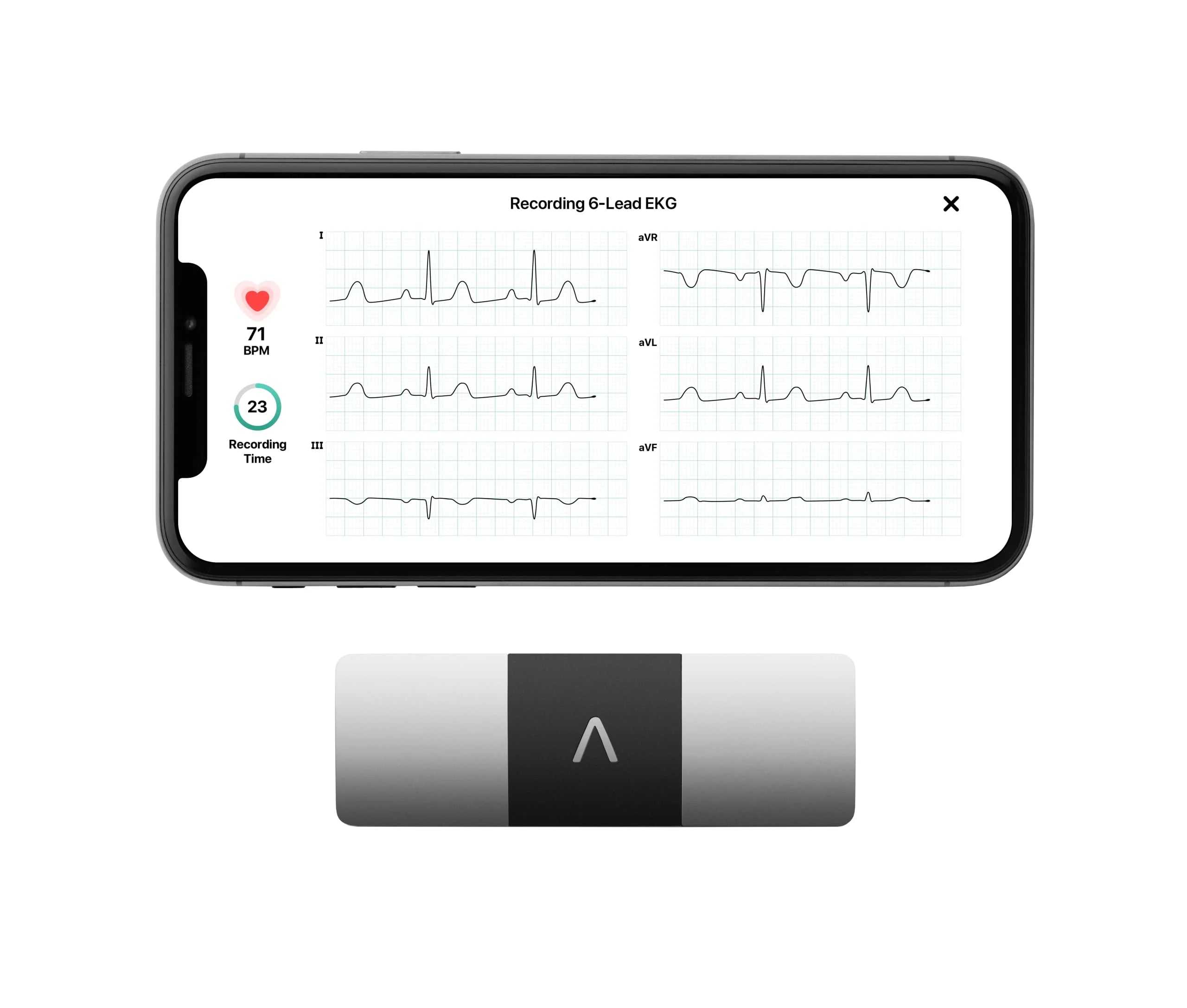 KardiaMobile 6L Personal EKG Monitor